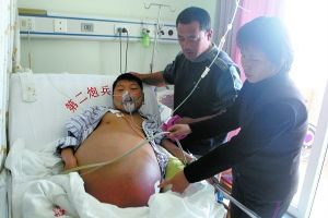20岁男孩腹部持续变大无法下床 获捐款进京治疗--中国国情手册