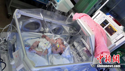 罕见“双头单体女婴”存活15天 多地专家会诊(图)--中国国情网